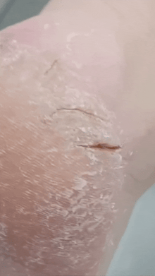 Before - Increíble lo bien que funciona